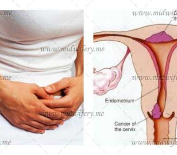 سرطان کنسر توده رحم، مرکز خدمات پرستاری و مامایی با روشی نوین در منزل با بیش از 15 سال سابقه درخشان در زمینه ارائه خدمات پرستاری، نگهداری و مراقبت و اعزام پرستار بیمار در منزل به صورت شبانه روزی(مراقبتی و توانبخشی)